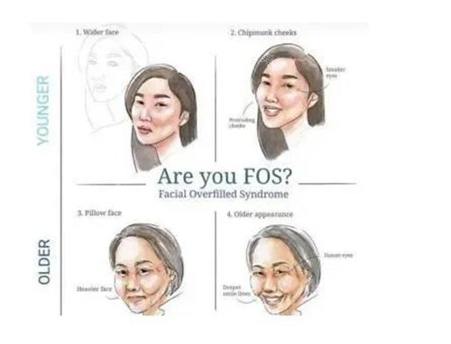 馒化脸示意图 馒化脸示意图