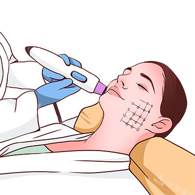 黃金微針操作圖 黃金微針操作圖