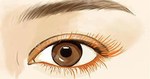 睫毛移植 睫毛移植