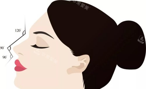 鼻整形示意图