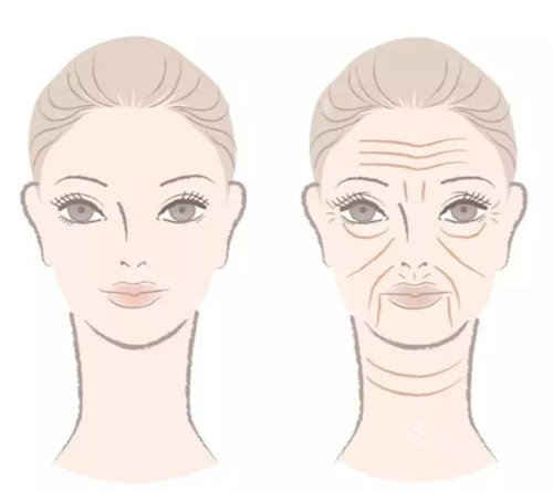 除皱抗衰前后对比、