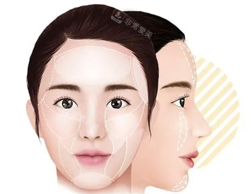 馒化脸需要修复部位图解 馒化脸需要修复部位图解