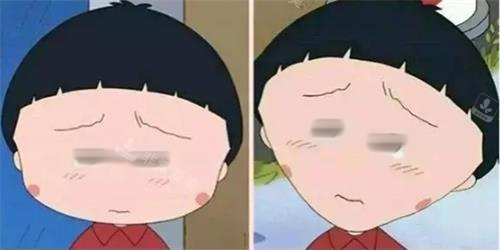 打针瘦脸前后明显对比图