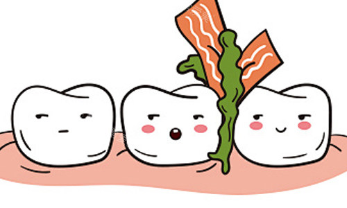 食物残留导致龋齿展示