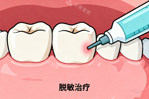 牙齿敏感治疗卡通图