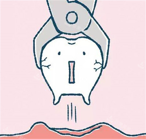 牙齿拔除过程展示