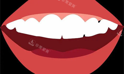 牙齿整齐卡通图