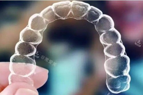 隐形矫正器模型图