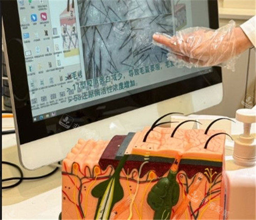 福州星采星和医美医院毛囊分析