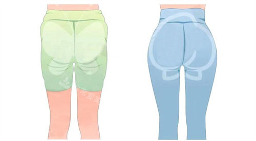 臀部吸脂手术背面对比动画图 臀部吸脂手术背面对比动画图