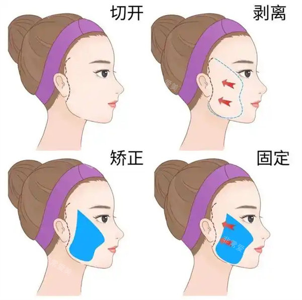 郭玉瑞医生囗碑如何？...