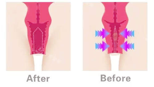 吴雪英成都棕南预约入口：点击获取院长预约号，尽享20年品牌老院的正规私密医疗服务