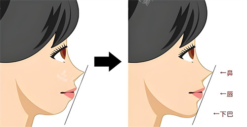 测一下是不是下巴内缩动画图 测一下是不是下巴内缩动画图