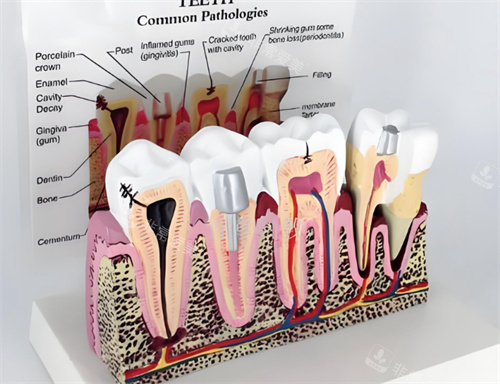 牙齿模型解剖图片
