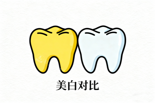 牙齿美白前后对比展示图