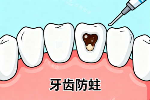 牙齿防蛀卡通图