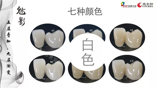 爱尔创全瓷牙魅影七种颜色