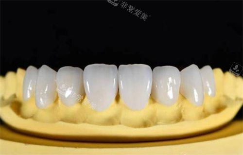 全瓷牙模拟展示