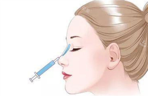 微晶瓷注射隆鼻过程