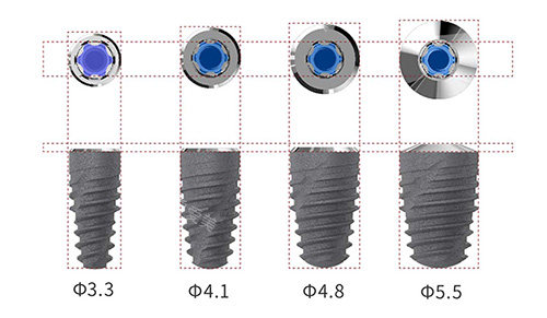 卡尔斯种植牙植体型号