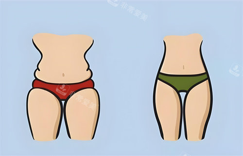 北京知音李奇军吸脂怎么样？这位院长的巴洛克形体雕塑技术真的超稳！