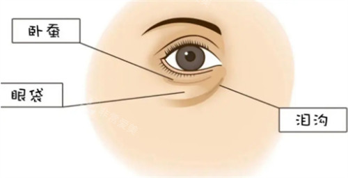 卧蚕眼袋和泪沟位置 卧蚕眼袋和泪沟位置