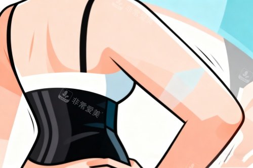 背部吸脂卡通展示图