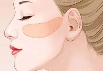 我在韩国脸型手术价格大揭秘！颧骨内推3.2W、下颌角4.5W，拆分做比套餐省1W，附医生资质查询技巧 