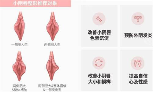 韩国信所爱女性医院小阴唇整形