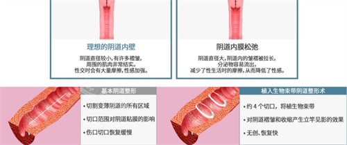 韩国信所爱女性医院生物束带技术