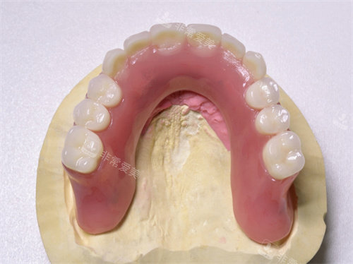 牙齿假牙模型