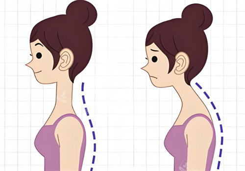 富贵包前后对比图