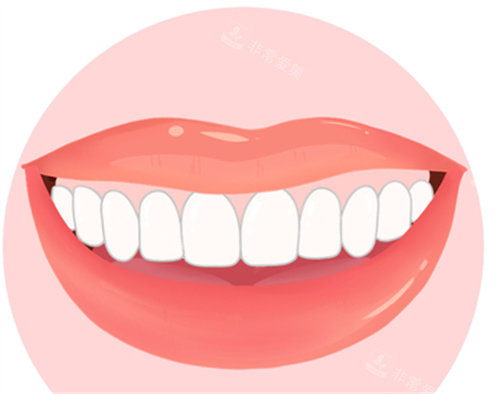 牙齿贴片效果图
