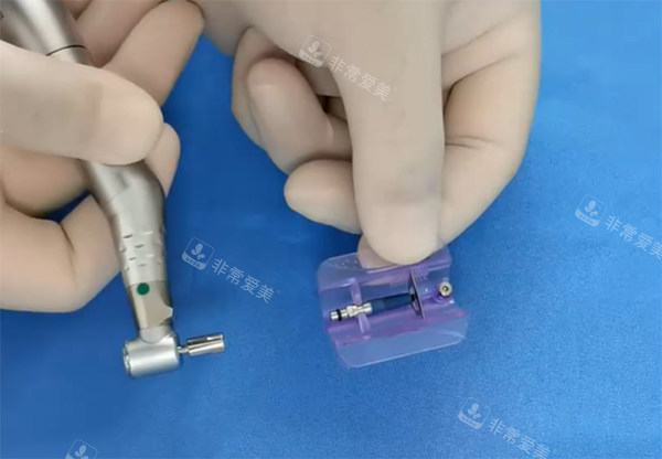 威高WEGO种植牙过程图