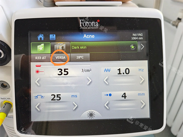 欧洲之星fotona好不好