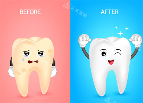 牙齿美白前后对比图展示