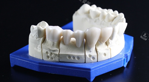 牙齿模型图
