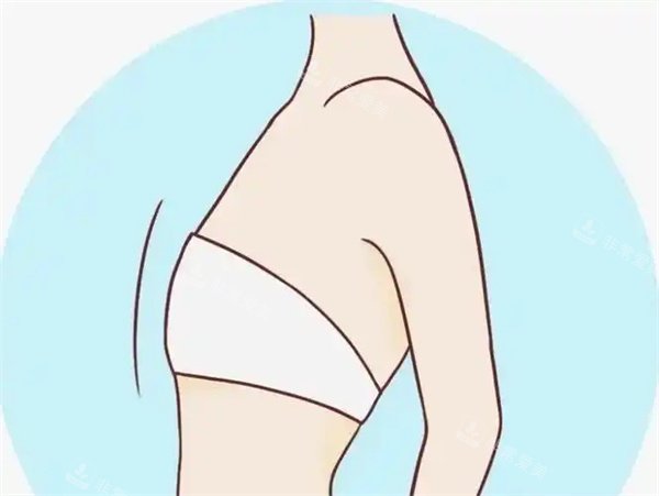 昆明博美整形胸部缩小手术全解析：技术、价格、病例与术后护理指南