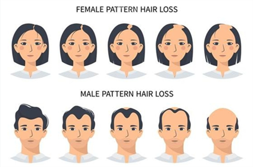 何建磊植发预约全攻略：线上+线下双渠道，轻松锁定何建磊医生号！