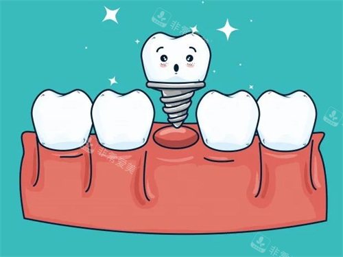 韩国种植牙哪家靠谱？goruda牙科，延世大学背景+精密种植！