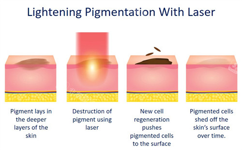 韩国江南佩切皮肤科预约方式：提前3天预约享折扣，中文翻译全程陪同无沟通障碍