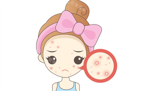 韩国江南佩切皮肤科怎么样？抗衰/祛痘技术好，10年经验院长亲诊