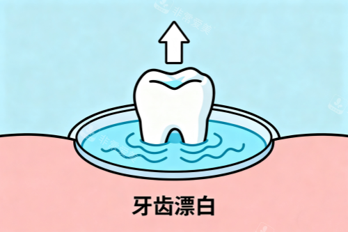 牙齿漂白卡通图