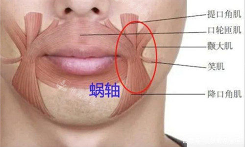 在韩口周年轻化打造过程分享！少女针填印第安纹+下颌缘瘦脸，韩国支架打法把嘴角“钉”回去