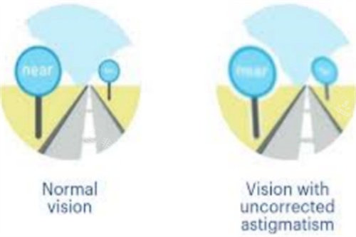 散光视物对比图
