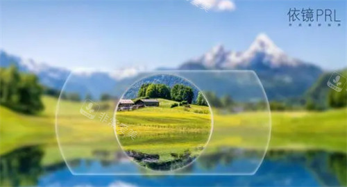 依镜PRL晶体植入术