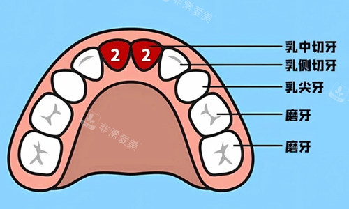 乳牙牙位展示