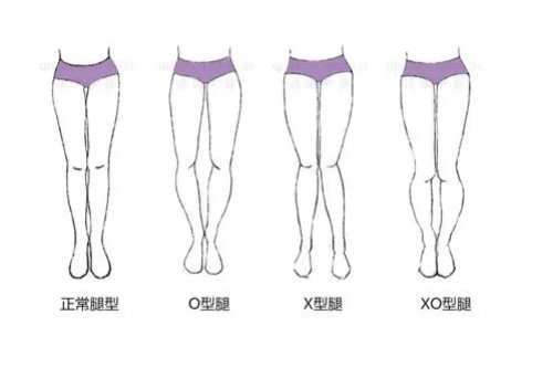 各种腿型卡通图 各种腿型卡通图