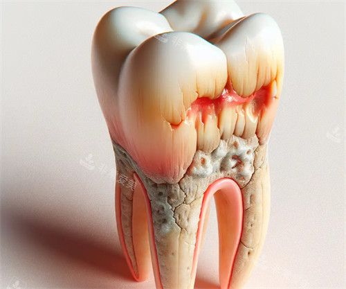 牙齿为什么会掉