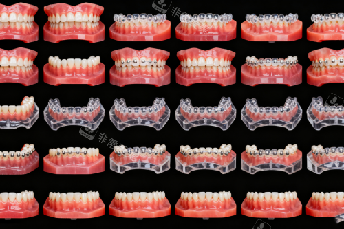 牙齿矫正步骤图展示